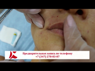 video красивые губы важнейший элемент гармоничного лица sex