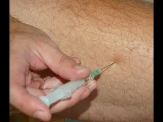 video внутримышечная инъекция в бедро intramuscular self injection sex