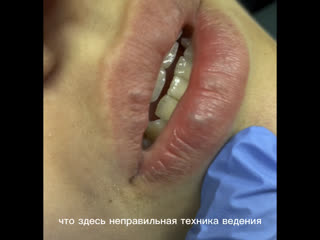 video видео от врач косметолог дерматолог г зеленодольск sex