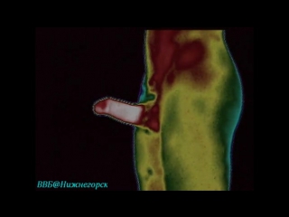 video тело человека период полового созревания sex