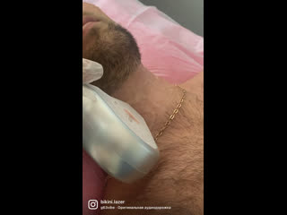 video видео от bikinilazer лазерная эпиляция в самаре sex