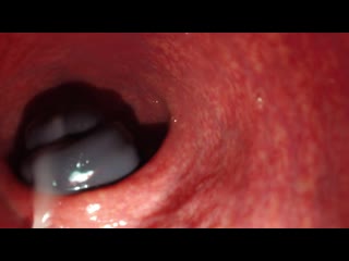 video камера внутри пизды кончание крупным планом скрытая камерапорноинц sex