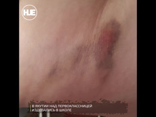 video в якутии маму которая спасла свою дочь от издевательств в школе хотели отдать под суд sex