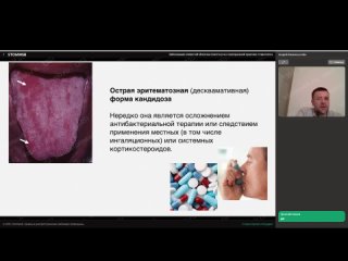 video заболевания слизистой оболочки полости рта лектор андрей финкельштейн sex