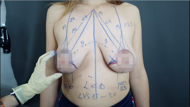video я всегда стеснялась своей груди подтяжка груди без имплантов sex