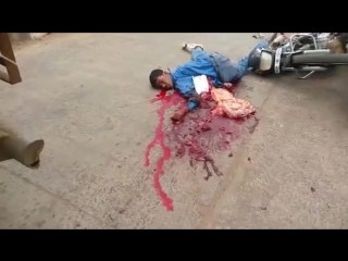 video побежал под грузовик остался с распущенными кишками sex