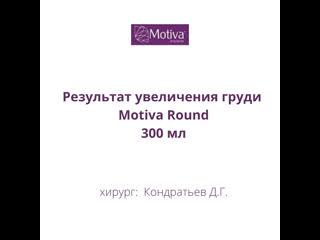 video результат увеличения груди круглыми имплантами motiva объемом 300 мл sex