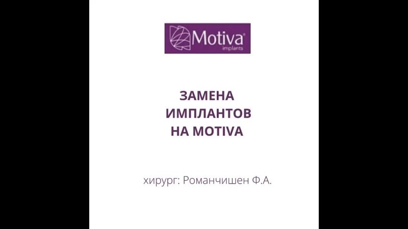 video замена имплантов через 18 лет после устанои sex