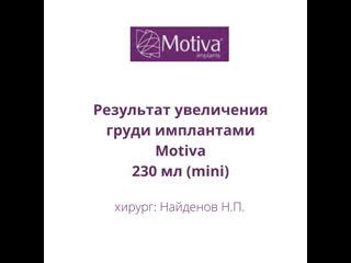 video результат увеличения груди через 2 недели после операции sex