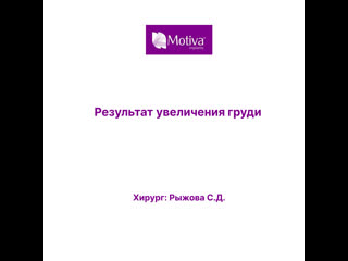 video результат увеличения груди небольшим имплантом sex