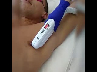 video лазерная эпиляция для мужчин sex