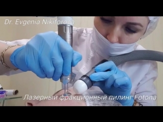 video фракционное омоложение в эстетик клубе sex