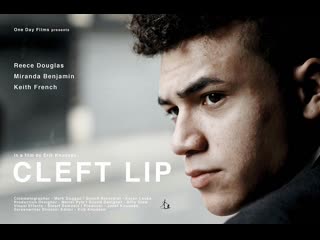video заячья губа cleft lip 2018 великобритания sex
