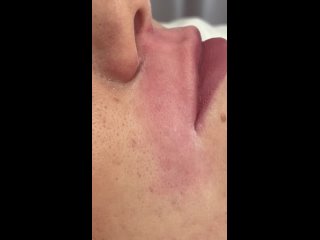 video видео от шугаринг электроэпиляция с любовью нижний тагил sex