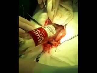 video мужчина засунул в анальное отверстие стеклянную литровую бутылку а вытащить обратно уже не смог удивлены были даже sex