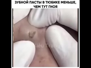 video зубной пасты в тюбике меньше чем тут гноя sex