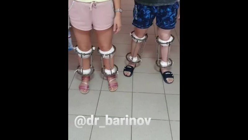 video look how confident our patients walk just after starting fixation period sex