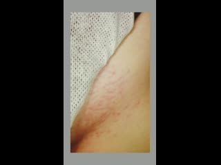 video видеозаписи электроэпиляцияистраонтакте sex