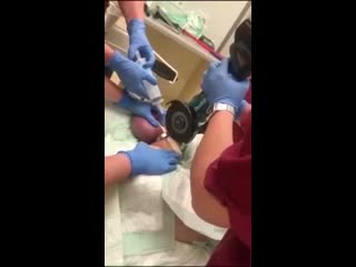 video бедным хирургам на минутку пришлось стать сантехниками sex