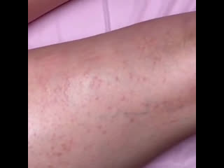 video видео от шугарингдепиляцияжк чистое небокомендантский sex