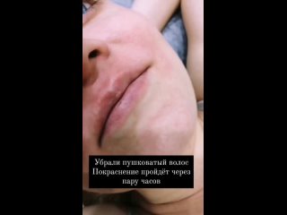 video видео от лазердепиляцияобучение татьяна елистратова sex