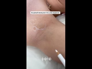 video видео от лазерная эпиляция восковая армавир nasti sugari sex