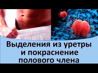 video выделения из уретры и покраснение полового члена sex