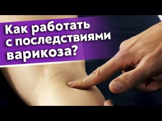video как избавиться от варикоза лечение варикоза массажем sex