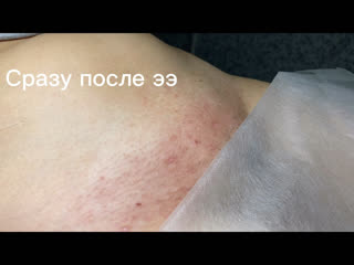 video видео от наталья пермитина электроэпиляция в смоленске sex