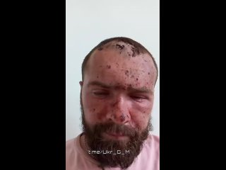 video брошенный на произвол судьбы после ранения боевик вынужден просить помощи у сограждан так как использованный sex