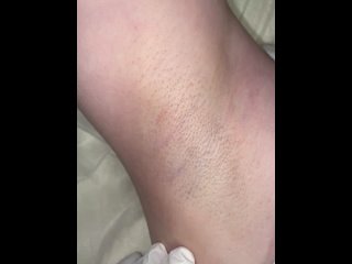 video видео от лазерная эпиляция массаж одинцовотрехгорка sex