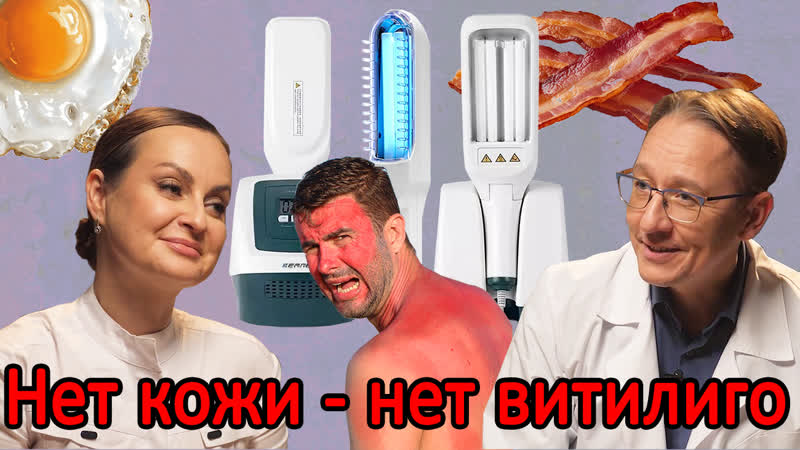 video обзор лампы 311 и лампы вуда облучаться или нет опасность рядом отзывы sex