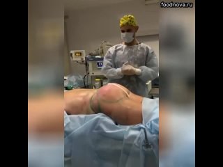 video рекомендуем вам канал пластического хирурга кандидата медицинских наук пиманчева павла вячеславов sex