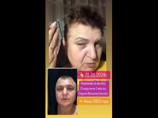 video отзыв на шампунь абсолют от атоми девчонки уже спросили это реально твои седые волосы sex