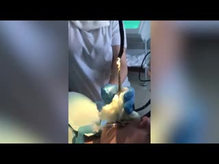 video огромная змея заползла в рот россиянке во сне sex