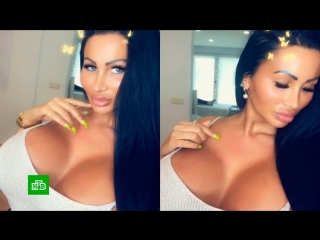 video немецкая барби закачала в грудь 10 литров силикона sex