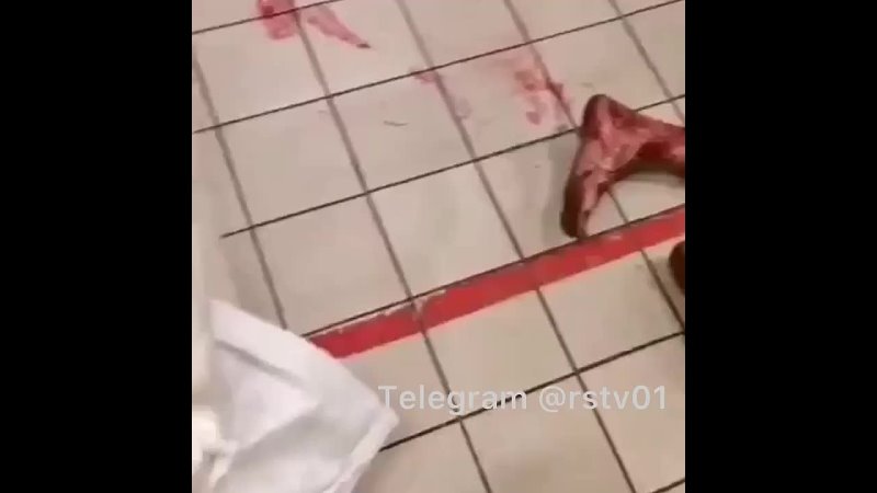 video в станице мечетинской бультерьер покусал своего хозяина в магазине sex