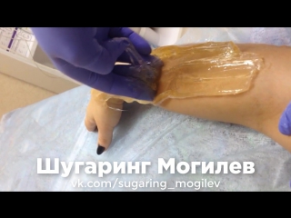 video процедура шугаринга депиляция сахаром зона руки могилев sex