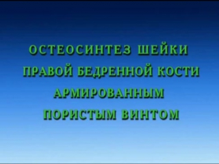 video хирургическое лечение переломов и ложных суставов шейки бедренной кости sex