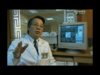 video моя ужасная история мальчик с опухолью вместо лица sex