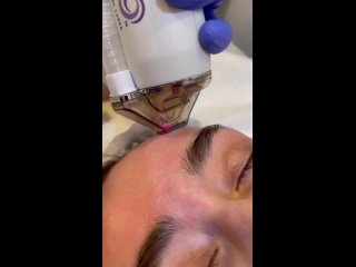 video лазерная шлифоа halo halo уникальное лазерное устройство с помощью которого возможно перепрограммировать состояние sex
