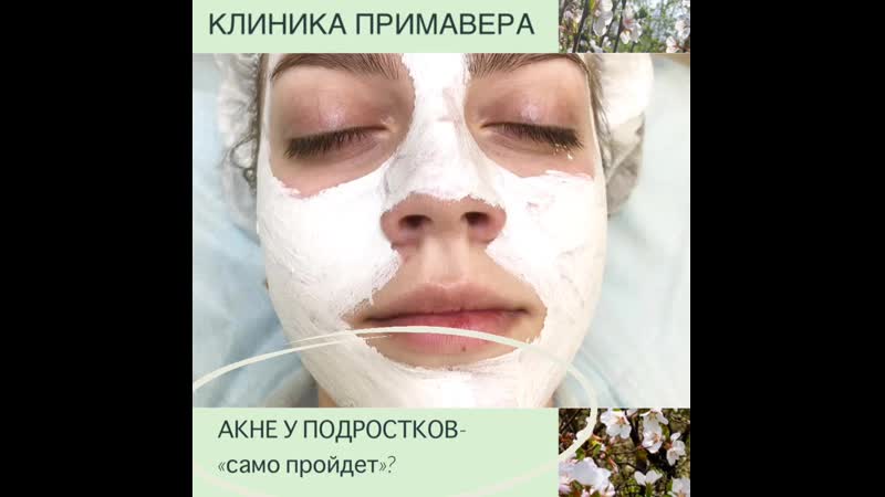 video примавера молодые акне sex