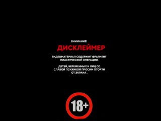 video эндопротезирование молочных желёз в клиника нм sex