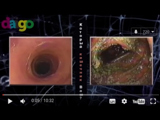 video патогенная микрофлора почему развивается рак самая безопасная пища sex