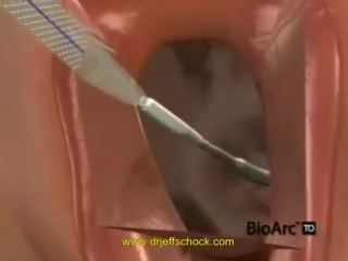 video bladder sling michigan urologist dr jeffrey schock ams tot sex