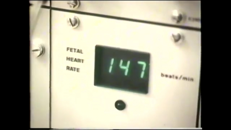 video ведение родов роды правильное ведение родов maintaining a normal childbirth sex