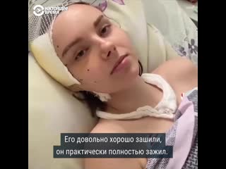 video пострадавшая во время протестов в минске уже месяц в больнице sex