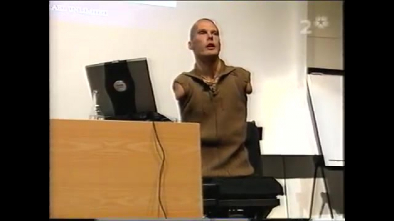 video mikael andersson armless legless peerless part 2 of 6 sex