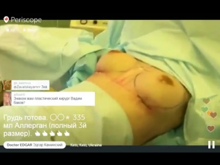 video доктор эдгар презентует грудь третьего размера sex
