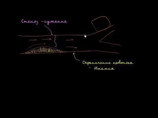 video стеноз ишемия и сердечная недостаточность sex